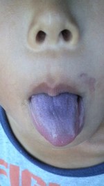 ブルーベリー食べつくした舌