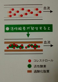 脳卒中や心筋梗塞と活性酸素