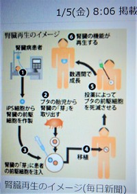 IPS細胞によって腎臓機能が再生　　yahooニュース